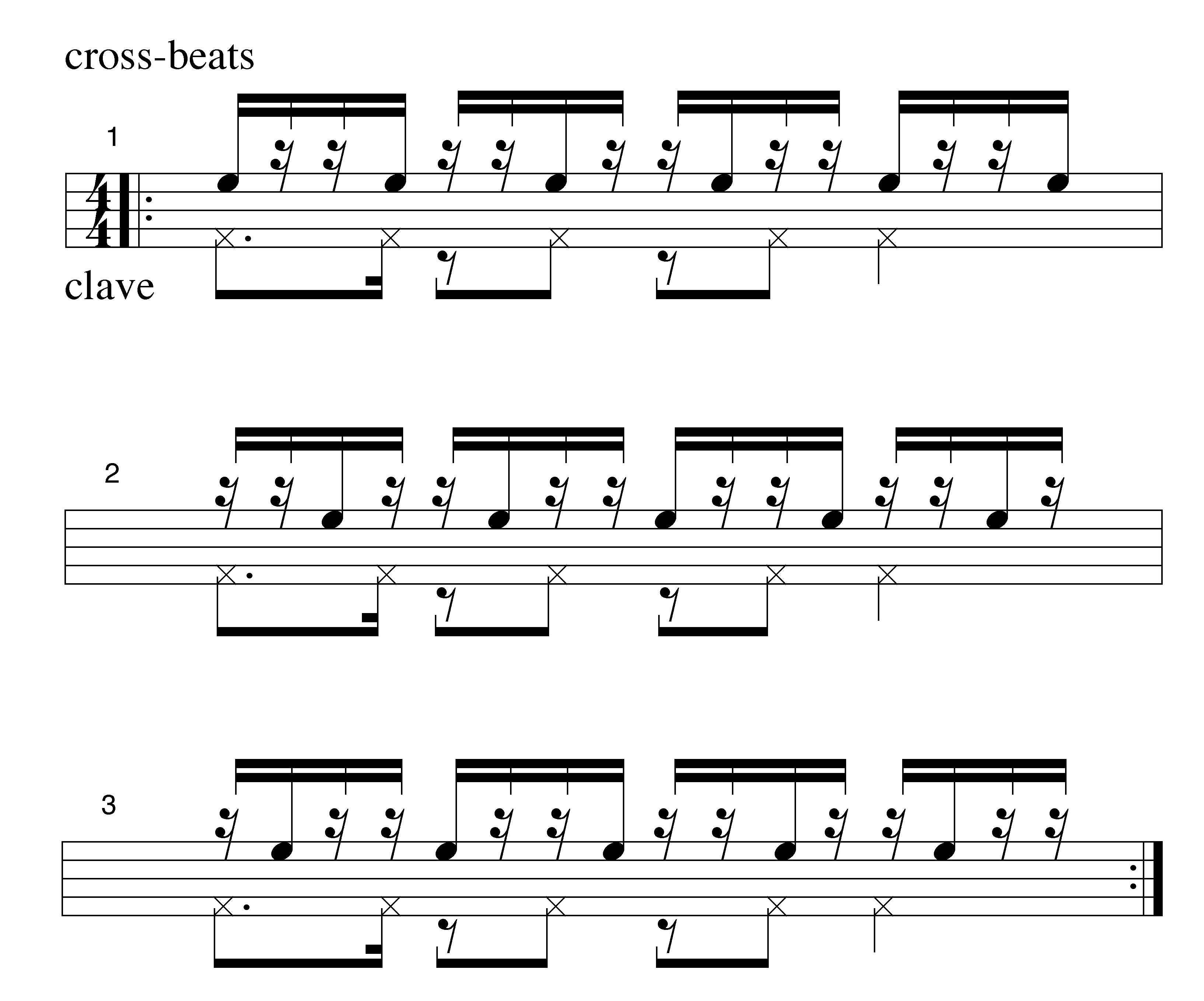 Terms about Rhythm in Music Theory - Syncopation or Measure -